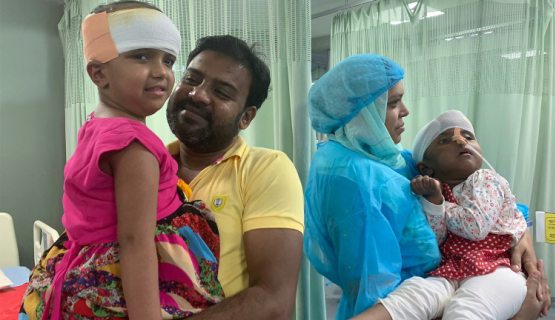 A szétválasztott bangladesi ikrek a szüleikkel a kórházban, 2019-ben