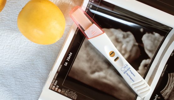 Terhességi teszt és ultrahangkép