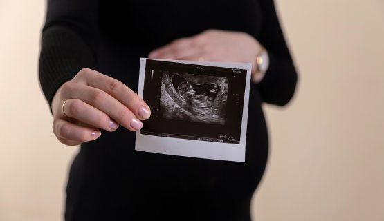 abortusz témájú cikk illusztrációja: várandós nő ultrahangfotóval