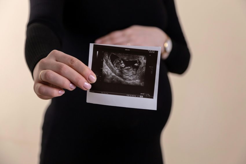 abortusz témájú cikk illusztrációja: várandós nő ultrahangfotóval