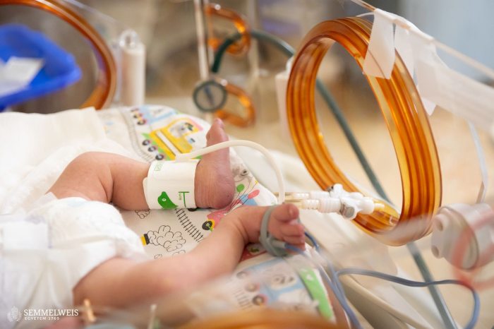 koraszülött baba Semmelweis klinika inkubátorában
