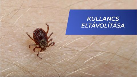 Kullancs kiszedése